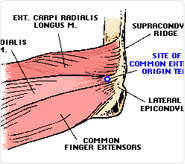 Elbow Surgery