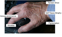 hand-rejuvenation