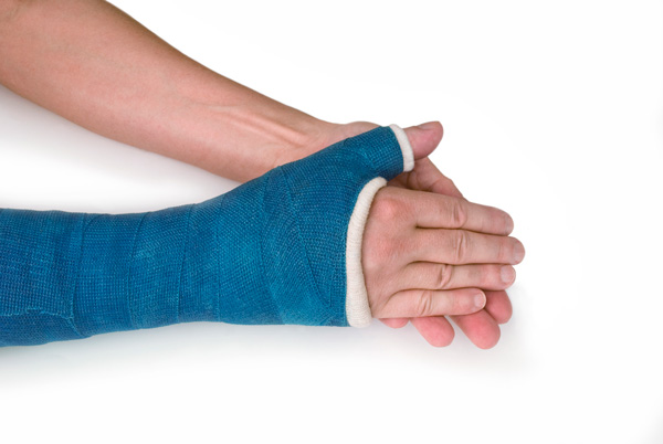 How does a cast help with the healing process of a broken thumb?