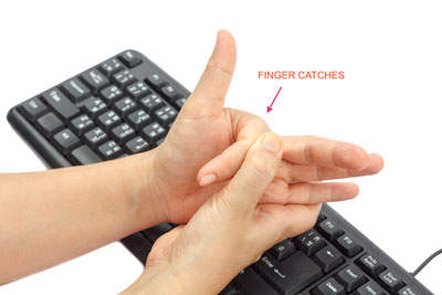 How can you relieve the pain of trigger finger without surgery?