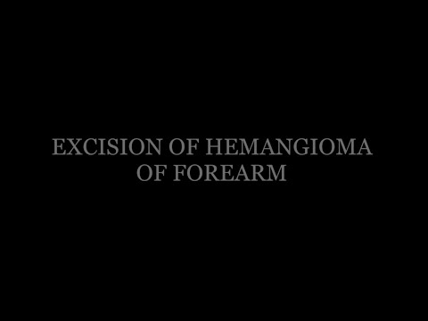 Excision of Hemangioma of Forearm