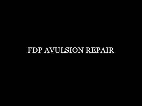 FDP Avulsion Repair