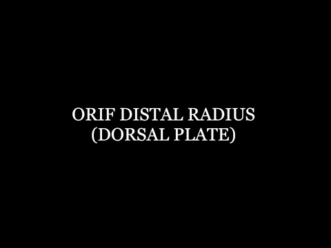 Orif Distal Radius (Dorsal Plate)
