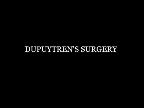 Dupuytren's Surgery