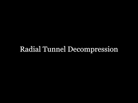 Radial Tunnel Decompression