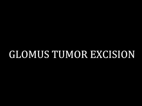 Glomus Tumor Excision