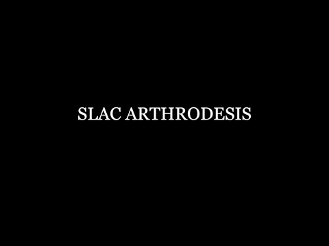 Slac Arthrodesis