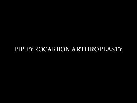 Pip Pyrocarbon Arthroplasty
