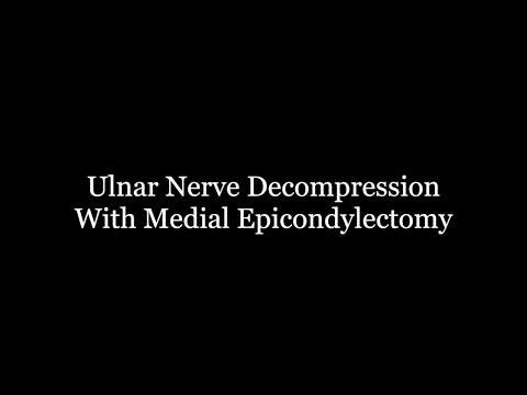 Ulnar Nerve Decompression With Medial Epicondylectomy
