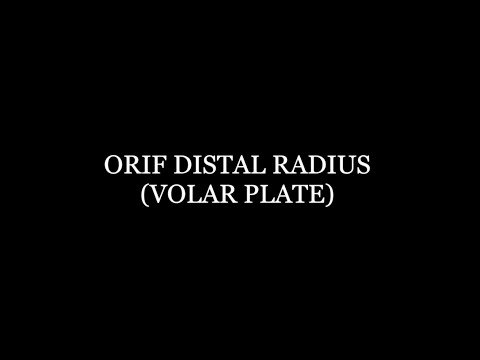 Orif Distal Radius (Volar Plate)