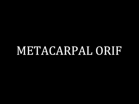 Metacarpal ORIF