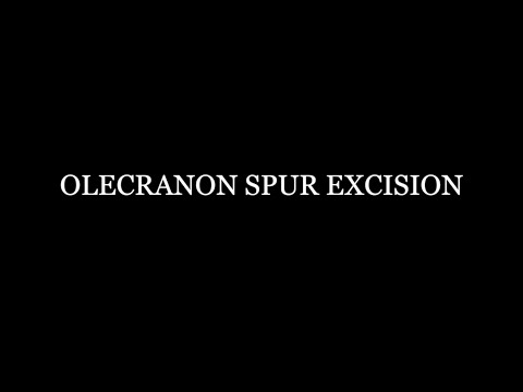 Olecranon Spur Excision