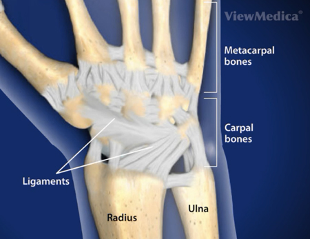 Diverse Klinik Skinnende Wrist Sprain Symptoms, Treatment In Dallas, & Recovery Time